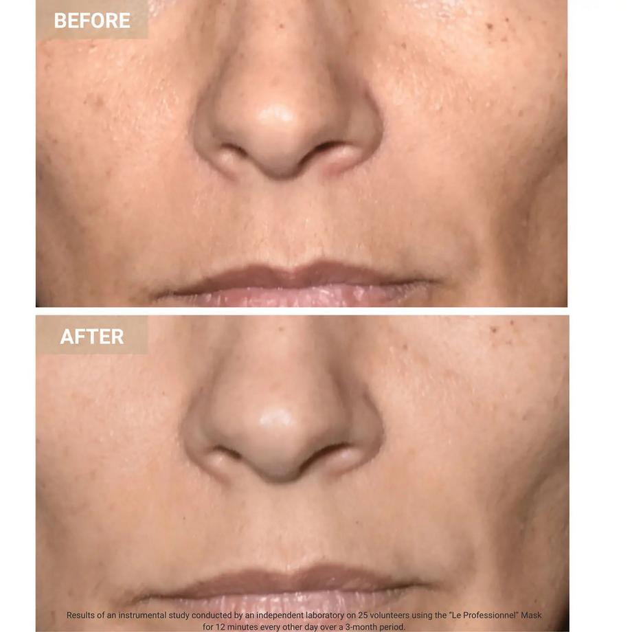 Nooance  Anti-Aging LED Face Mask The Professional  - Masque LED anti-age visage 