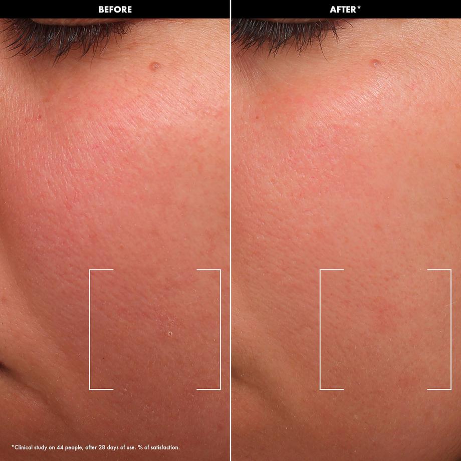 SEPHORA  HYDRATE - Balsamo in crema lenitivo con lipidi e ceramidi 