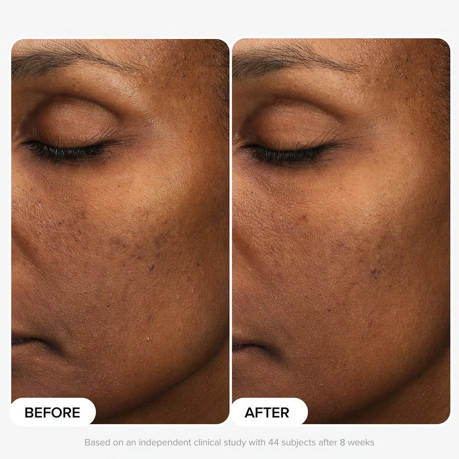 Paula's Choice  Multi-Level Exfoliation Trial Kit - Duo Découverte Exfoliants AHA + BHA 