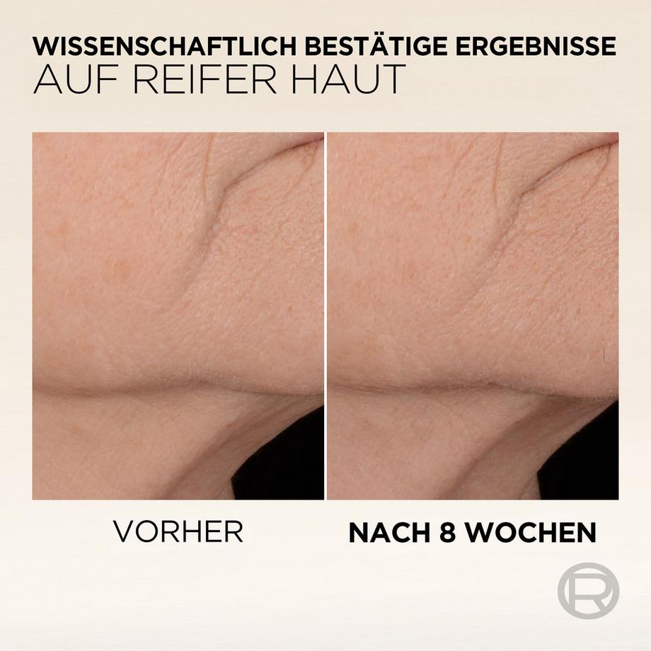 L'OREAL  Age Perfect Esperto Collagene siero rassodante effetto immediato 