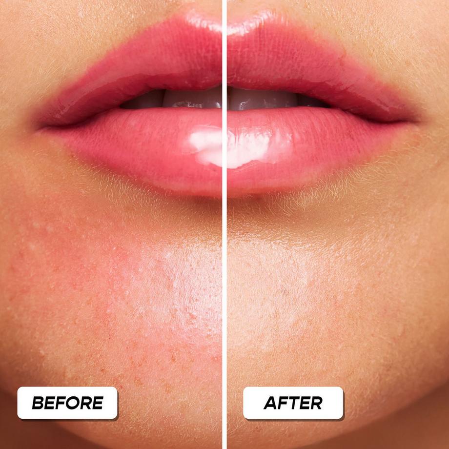 GLOWERY  Kissing Rash Remedy - Beruhigender Post-Kuss-Balsam 