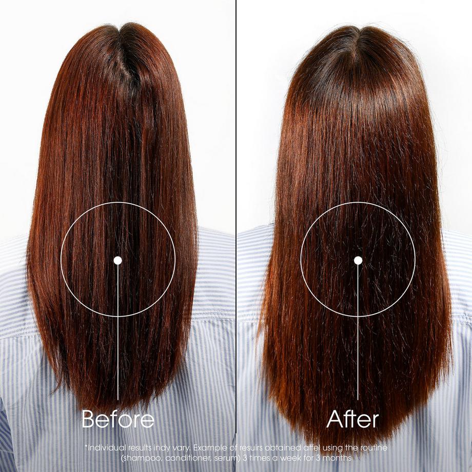 KLORANE  Baume soin anti‑chute à la quinine 