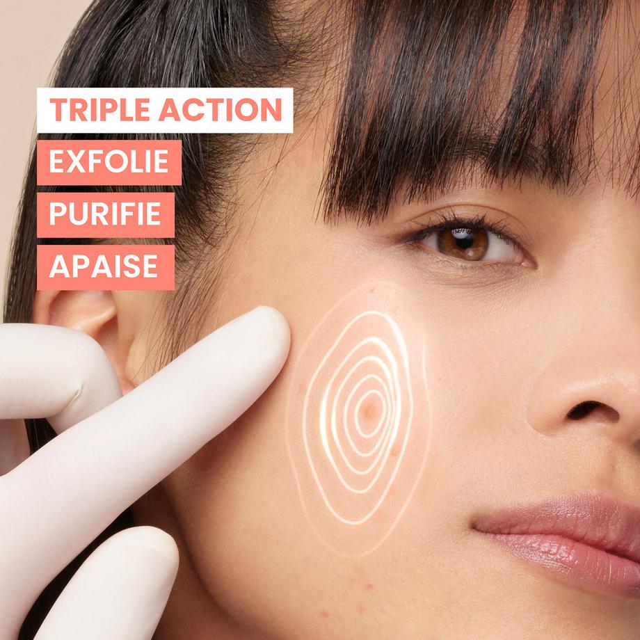 Avene  CLEANANCE COMEDOMED Peeling Reinigungsgel 