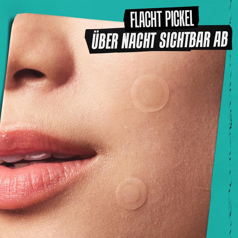 Kiehl's  Truly Targeted Overnight Blemish Patches 