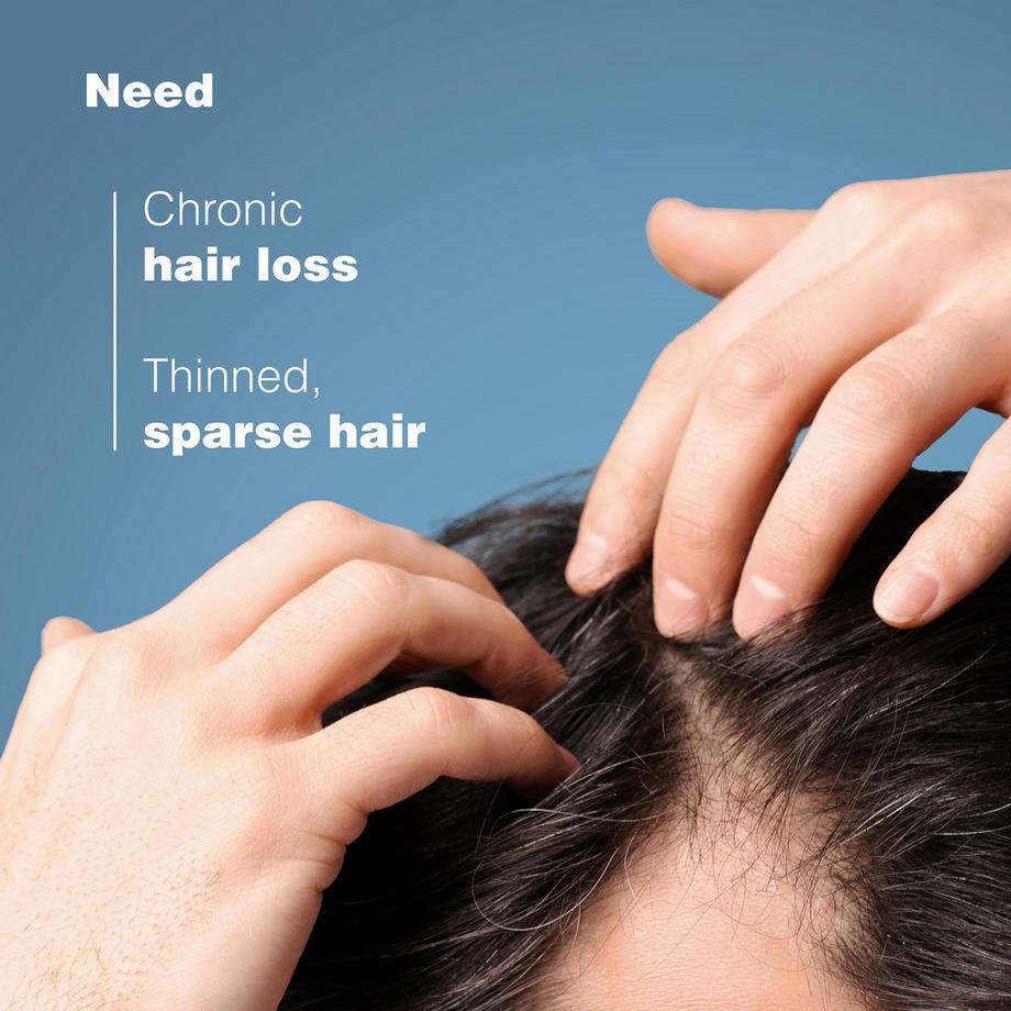 Ducray  Shampooing ANAPHASE REACTIV contre la chute des cheveux 