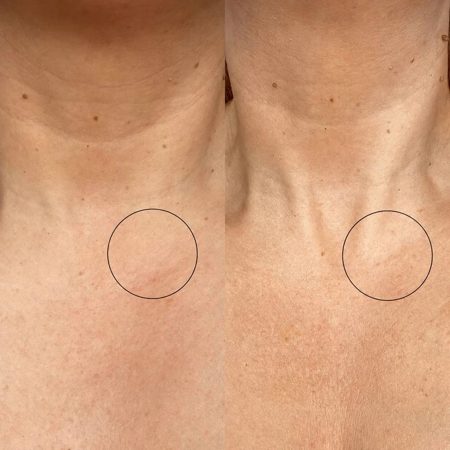 THE INKEY LIST  Bio-active Ceramide Neck Stick - Stick pour le cou à la céramide bio-active 