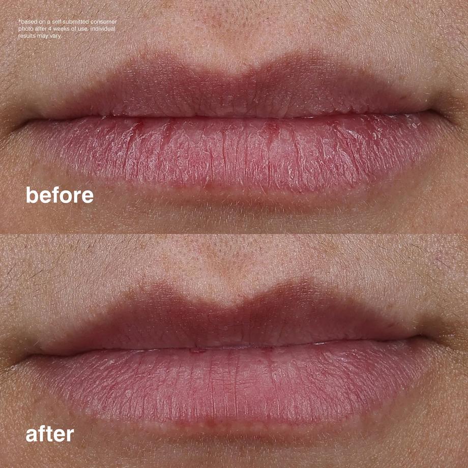 RHODE  Peptide Lip Treatment – Soin des lèvres nourrissant à effet glaçage  