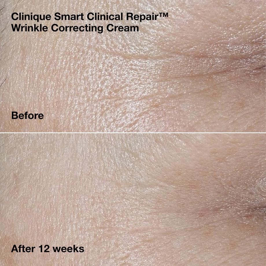 CLINIQUE  Wrinkle Correcting Routine 