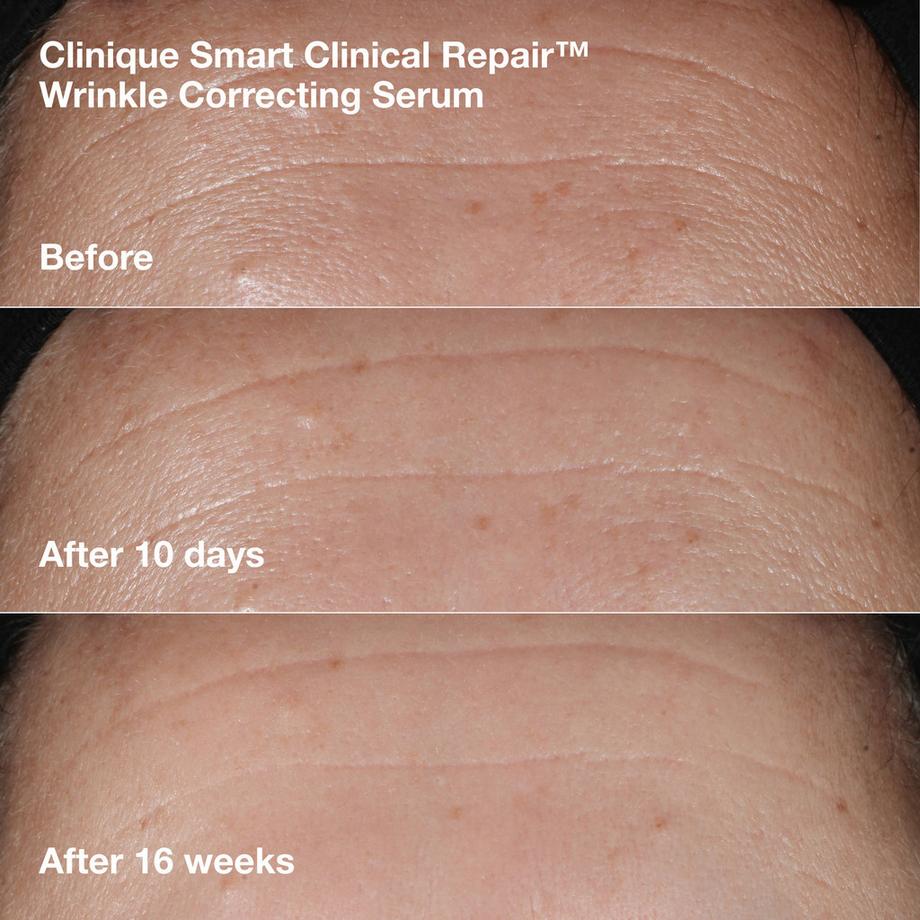 CLINIQUE  Wrinkle Correcting Routine 