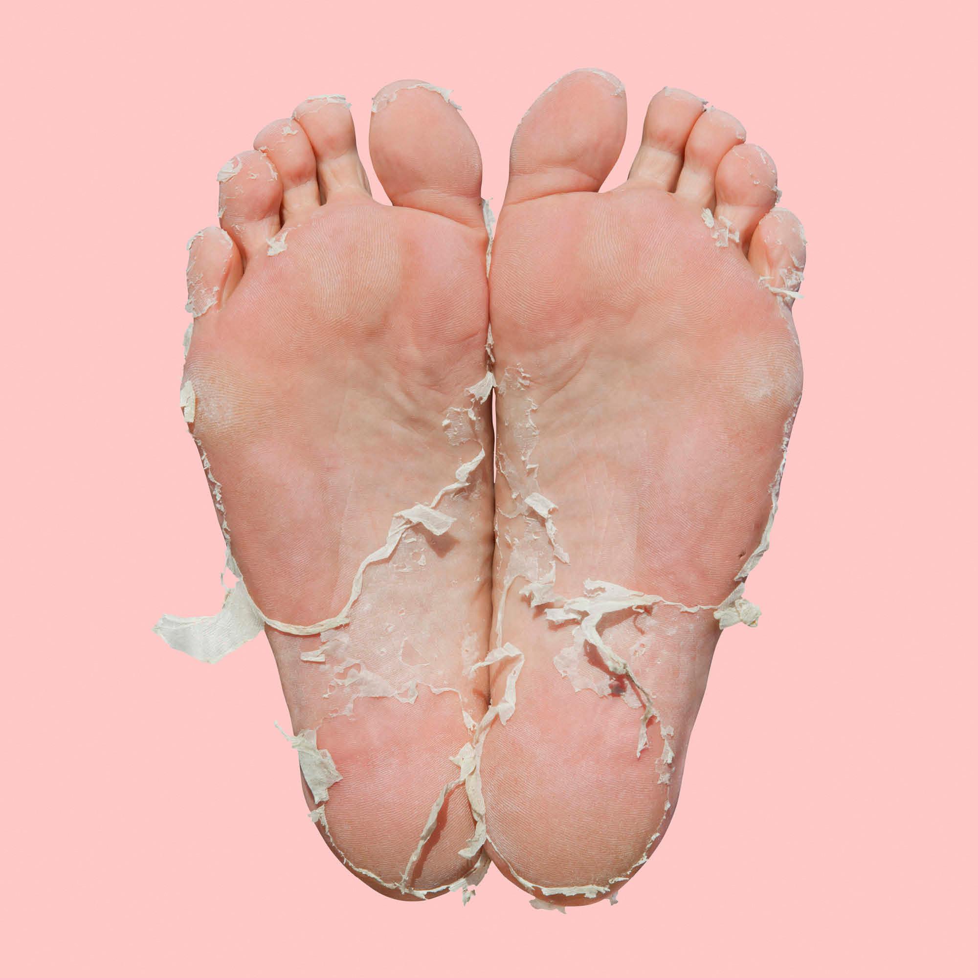 Skin republic Foot Peel Masque pour les pieds 