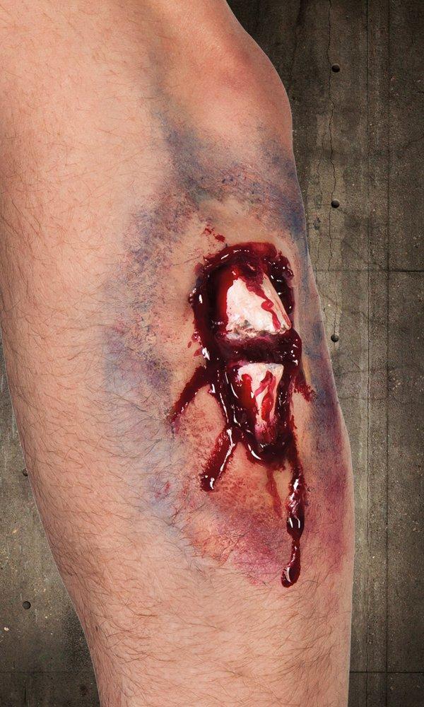 BOLAND  Latexwunden, Zufallsauswahl 