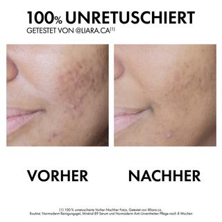 VICHY  Normaderm Phytosolution Gesichtspflege Normaderm Double Correction Pflege 