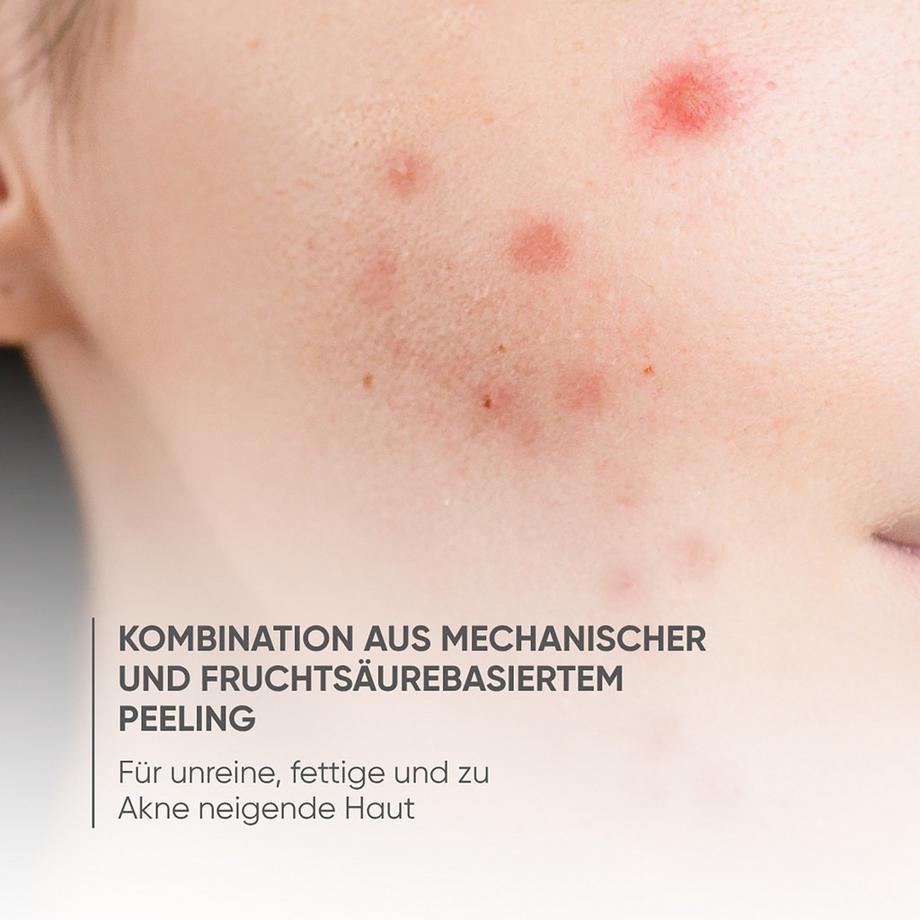 Louis Widmer  skinappeal Peeling 