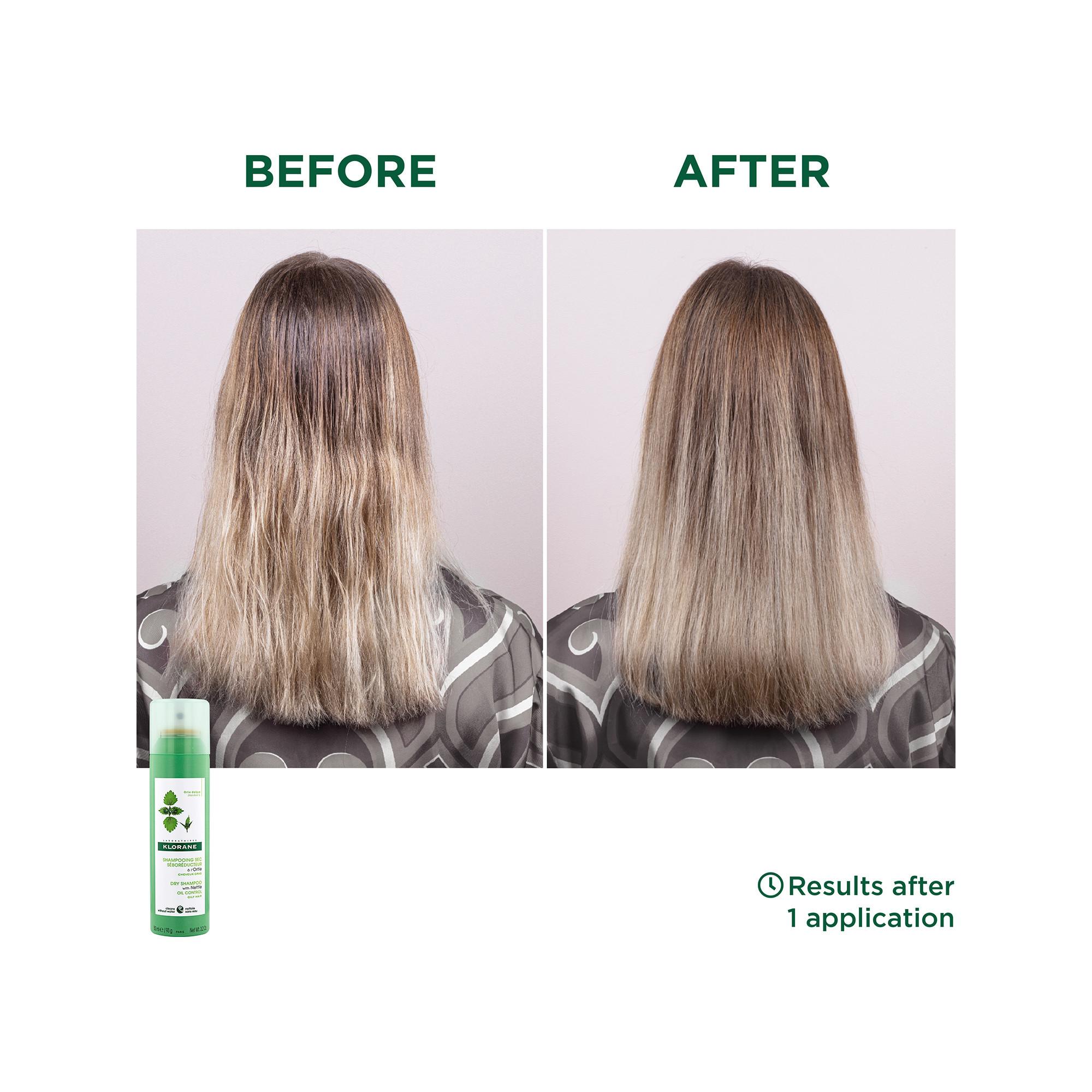 KLORANE IO-Brennnessel Reinigendes Trockenshampoo 