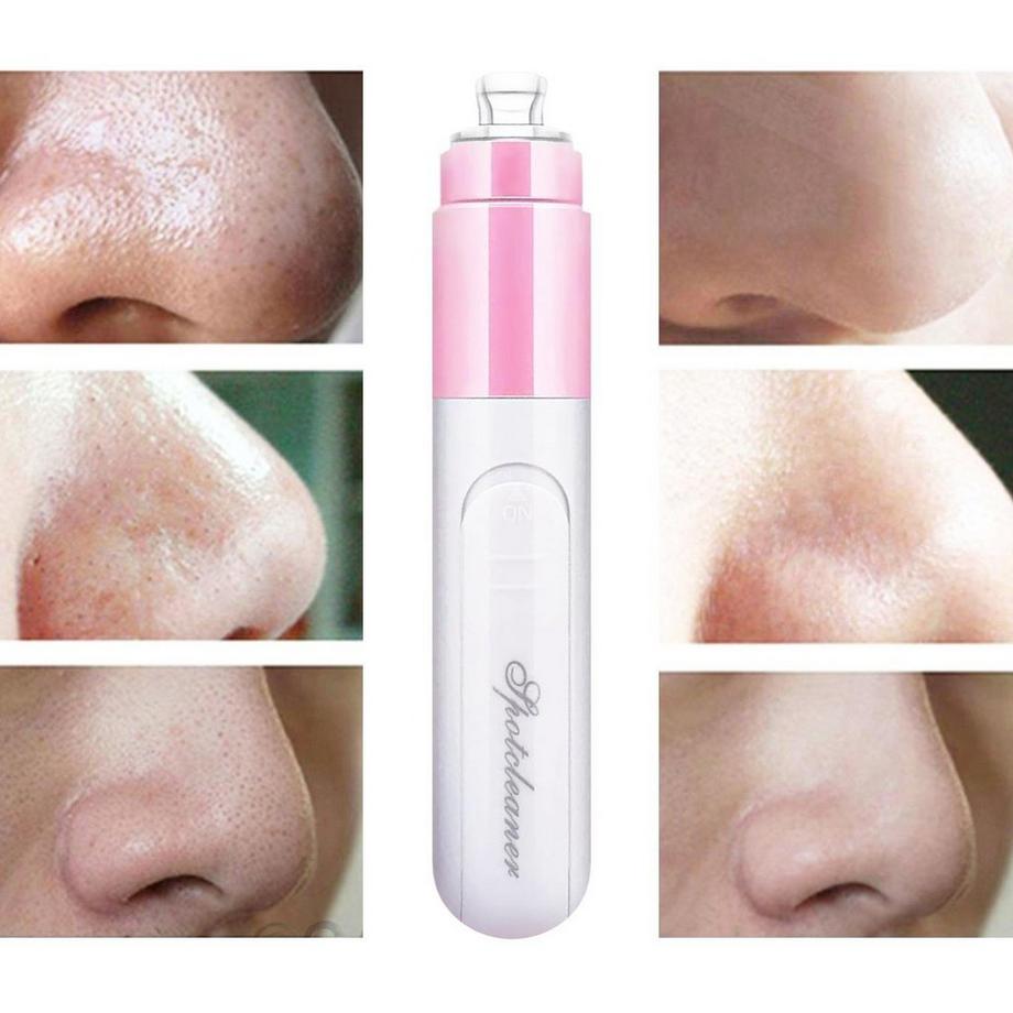 eStore  Elektrischer Mitesserentferner - Pink 