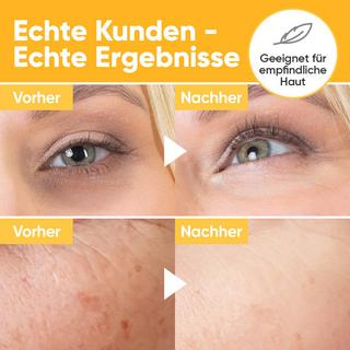 âme pure  Retinol & Vitamin C Serum- Feuchtigkeit Gesichts- Serum gegen Flecken, Augenringen, Tränensäcken, feinen Linien und Falten 