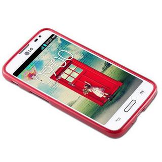 Cadorabo  Housse compatible avec LG L70 (1. SIM) - Coque de protection en silicone TPU flexible au design brossé 