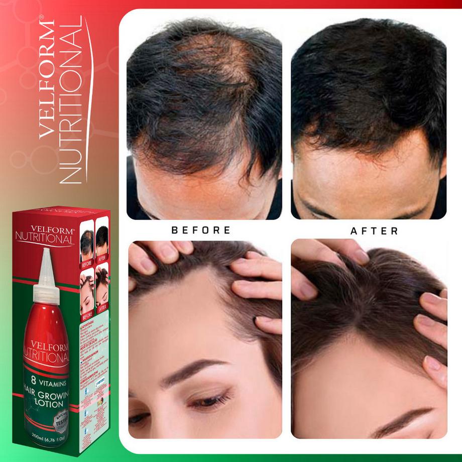 VELFORM  Nutritional - Tonique capillaire anti-chute 