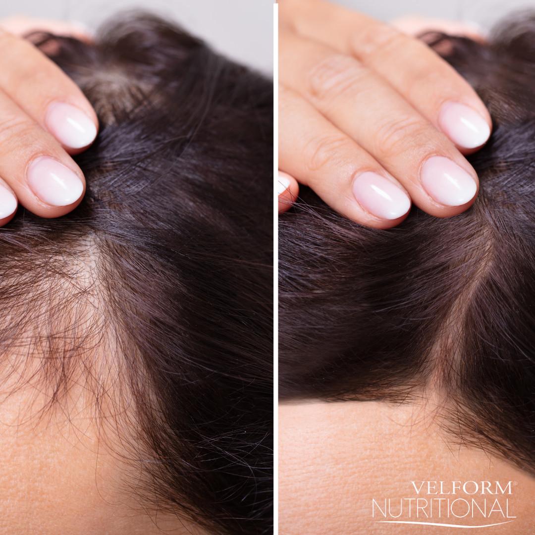 VELFORM  Nutritional - Anti-Haarausfall-Haarwasser 