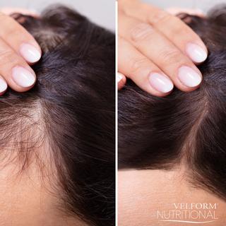 VELFORM  Nutritional - Anti-Haarausfall-Haarwasser 
