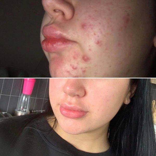 Eco by Sonya Driver  Esfoliante Viso Super Acai 