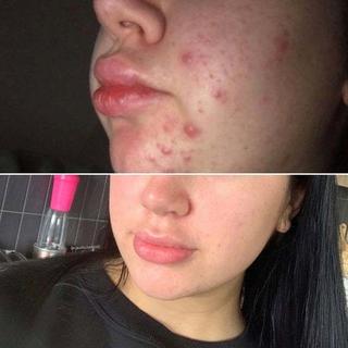 Eco by Sonya Driver  Super Acai Gesicht Peeling 