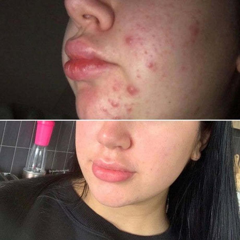 Eco by Sonya Driver  Super Acai Gesicht Peeling 