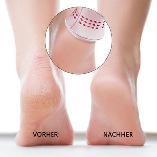 AILORIA LUSTRE Elektrischer Hornhautentferner (USB)  