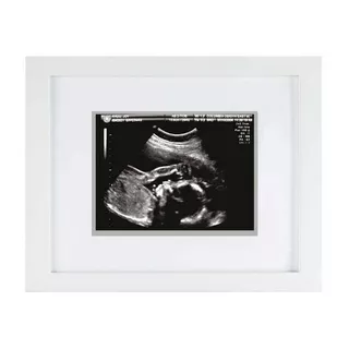 Pearhead  Sonogramm Fotorahmen 