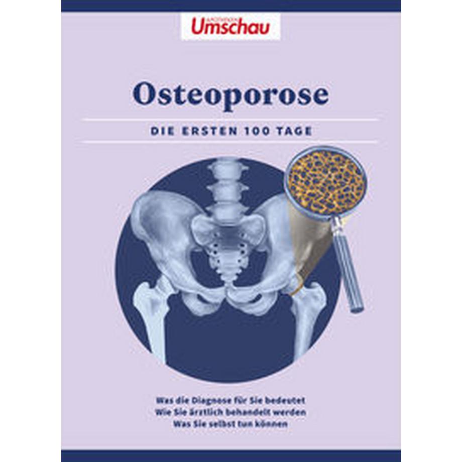  Apotheken Umschau: Osteoporose 
