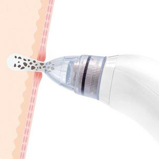 InnovaGoods Elektrischer Mitesserentferner  