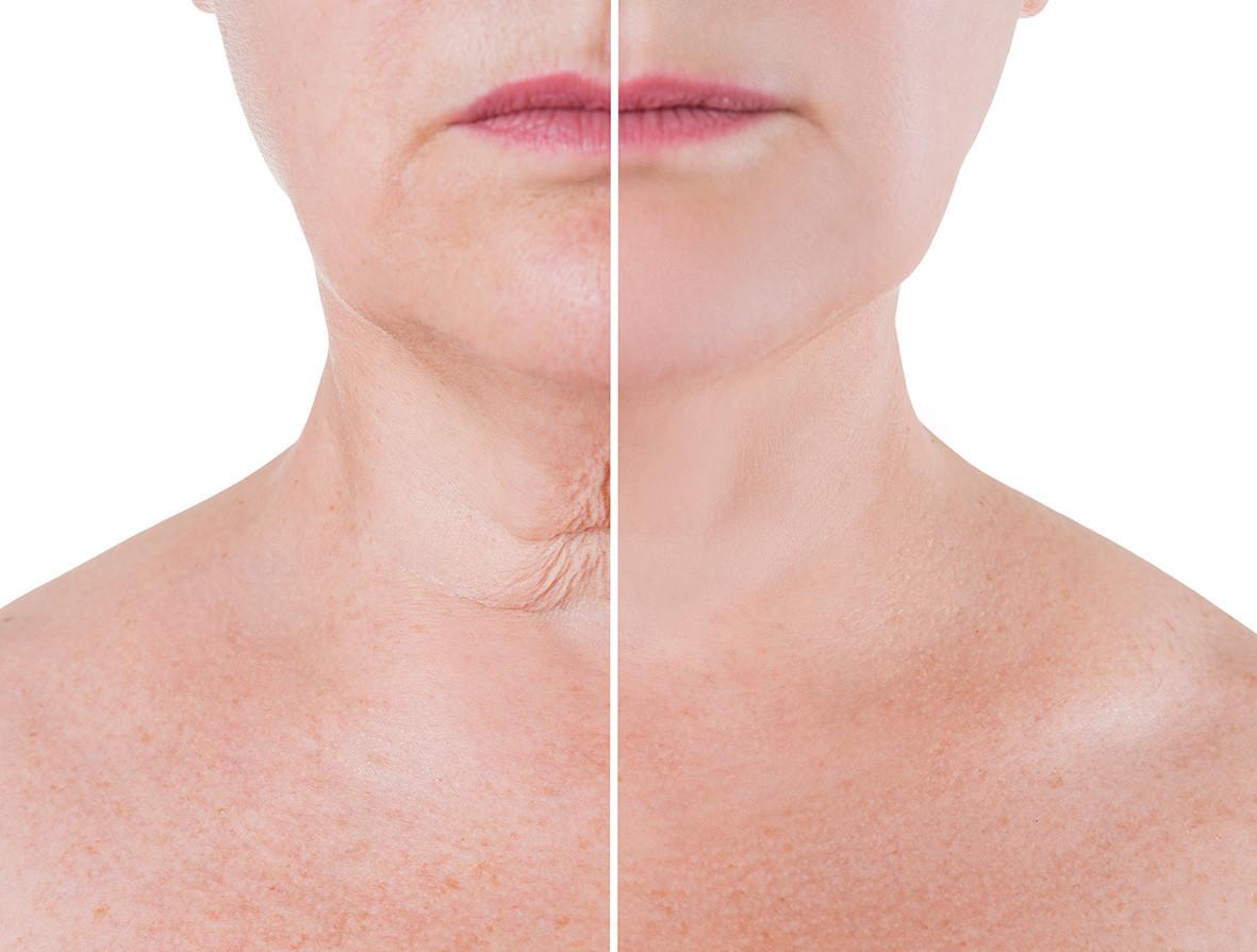 VELFORM  New Today Plus-Crème régénératrice pour le visage 