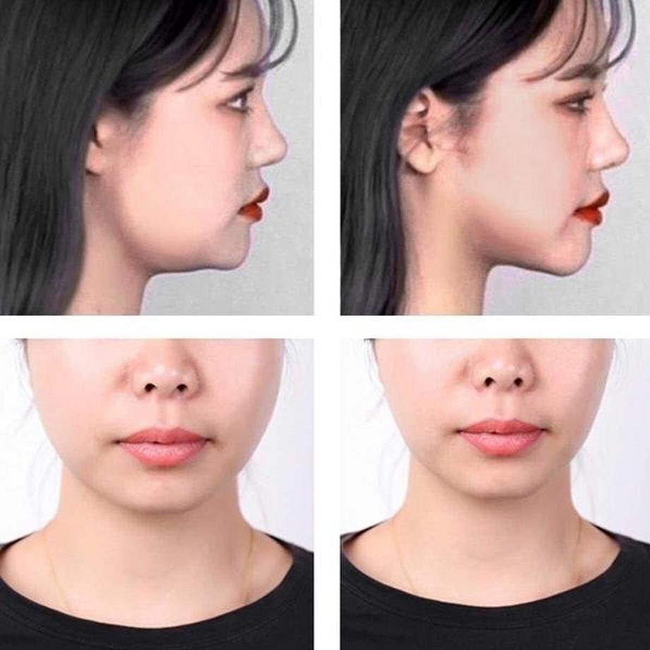 B2X  Face tape pour Lifting Temporaire du Visage - 60 pcs 