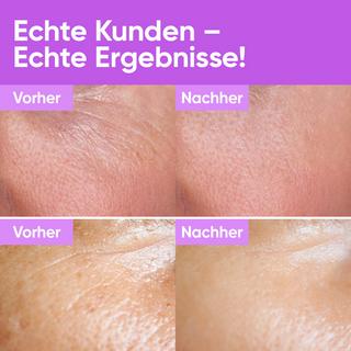 âme pure  Youth Concentrate Serum/ Anti-Aging-Wirkung Hyaluron Gesichtsserum/ Intensive Feuchtigkeitsversorgung 