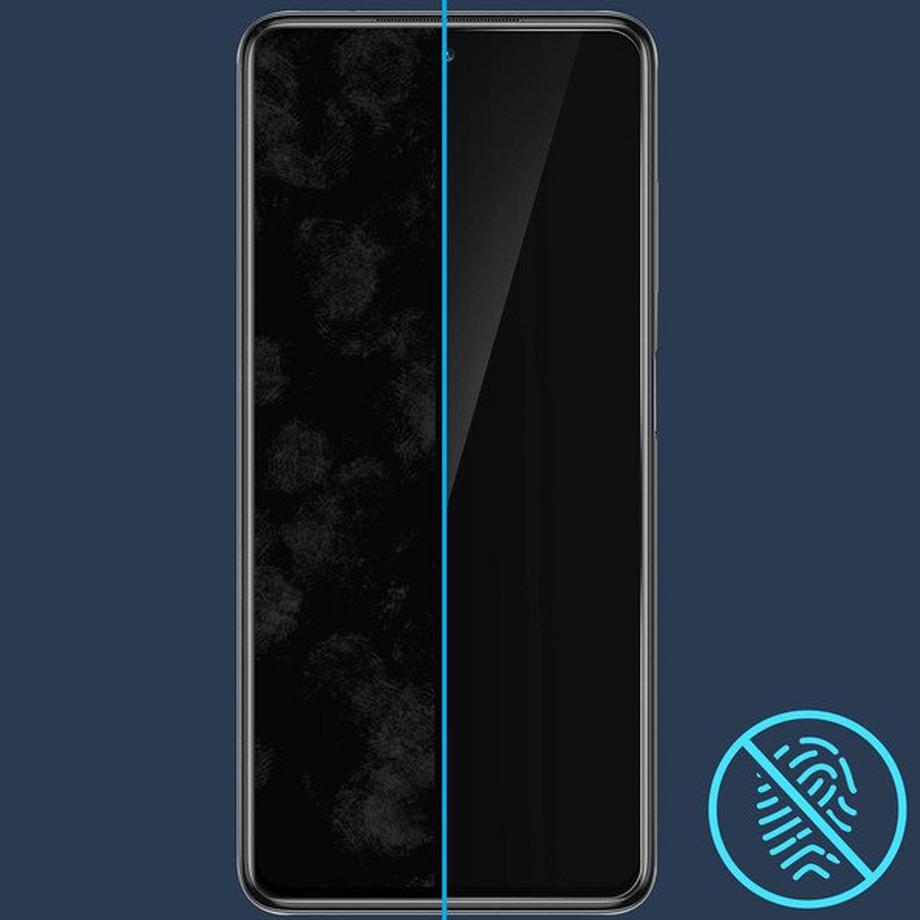 Avizar  Schutzfolie Xiaomi Poco X3 / X3 Pro 