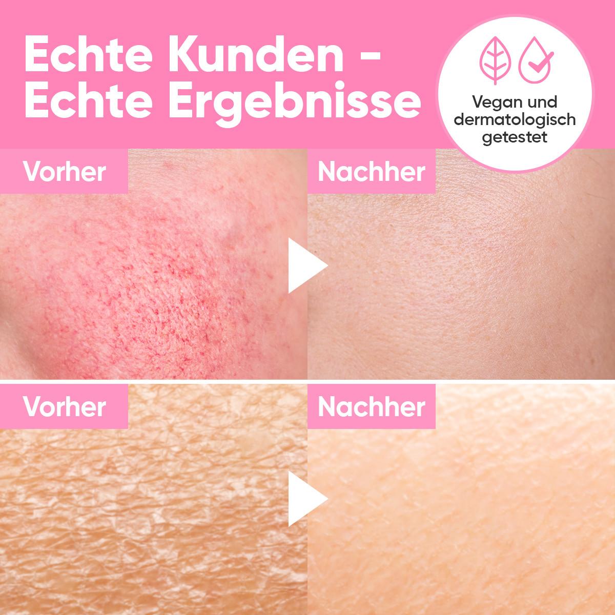 âme pure  Don't Be Thirsty Serum - Anti-aging Feuchtigkeitsserum fur Gesicht 