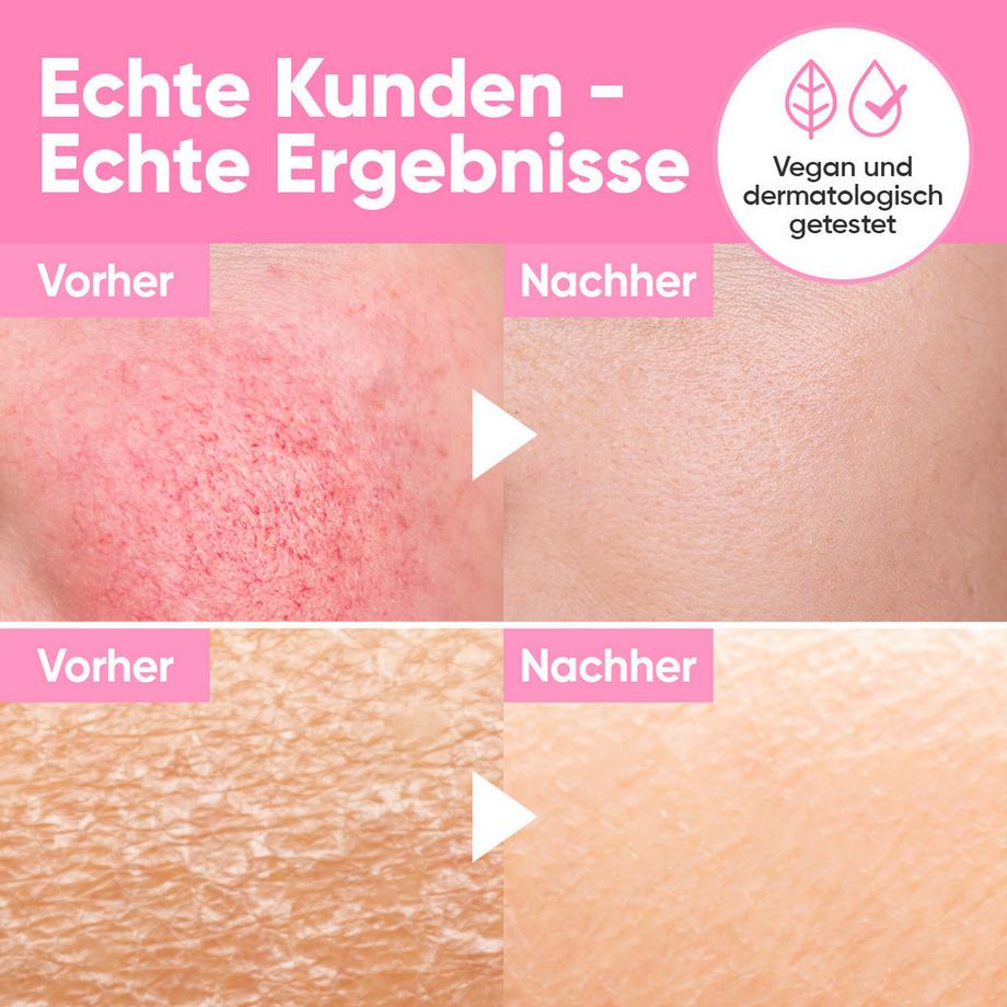 âme pure  Don't Be Thirsty Serum - Sérum hydratant anti-âge pour le visage 