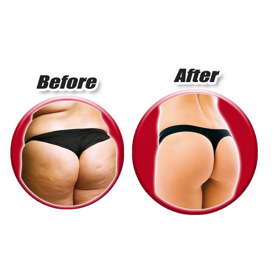 GYMFORM  Glutes - Appareil d'entraînement musculaire EMS pour les hanches et les fesses - muscles fessiers 
