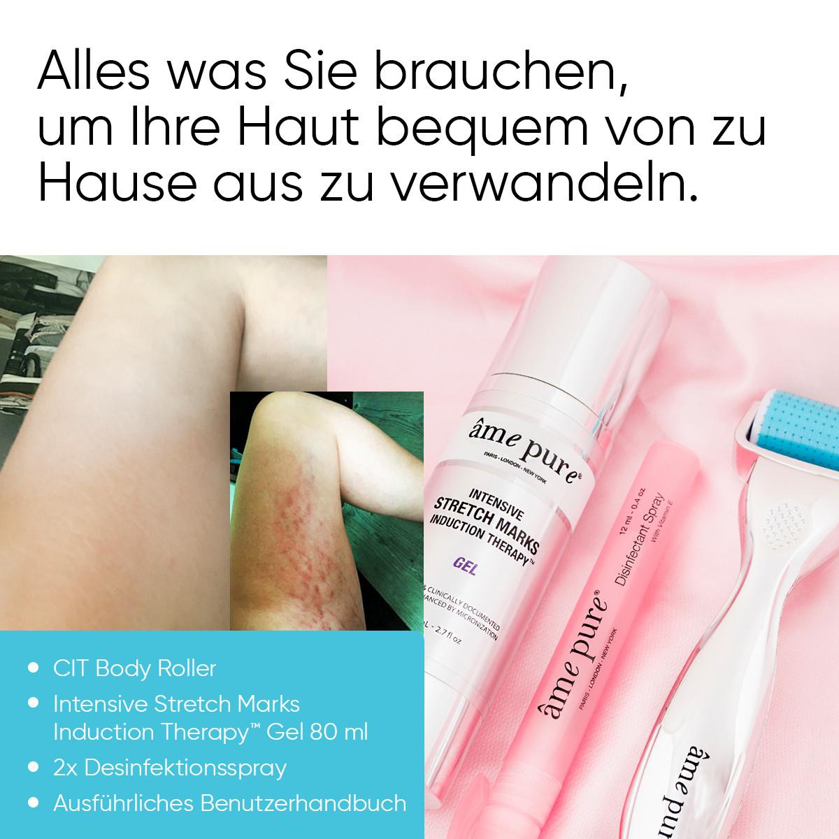 âme pure  Body Basic | Stretch Marks - Derma Roller Kit zur Entfernung von Dehnungsstreifen: CIT Body microneedling Roller + dehnungsstreifen Gel+ Sanitizer Spray 