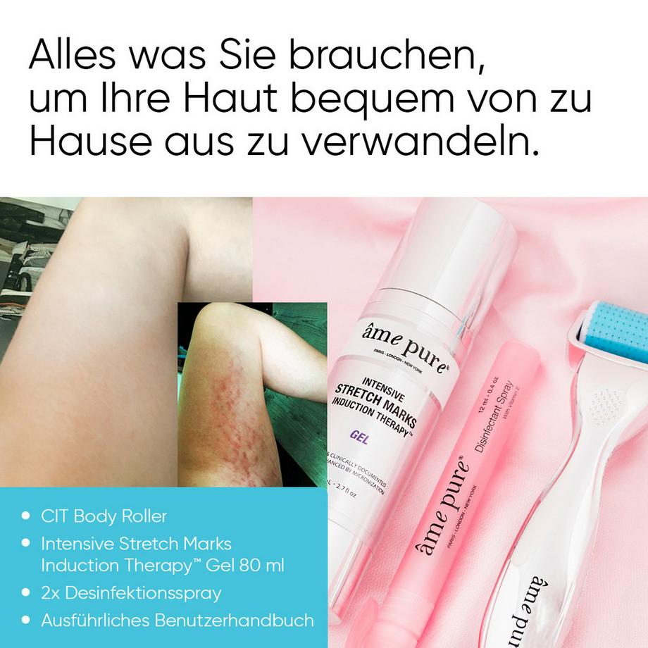 âme pure  Body Basic | Stretch Marks - Kit Derma Roller pour éliminer les vergetures : CIT Body microneedling Roller + gel anti- vergetures+ spray assainissant 