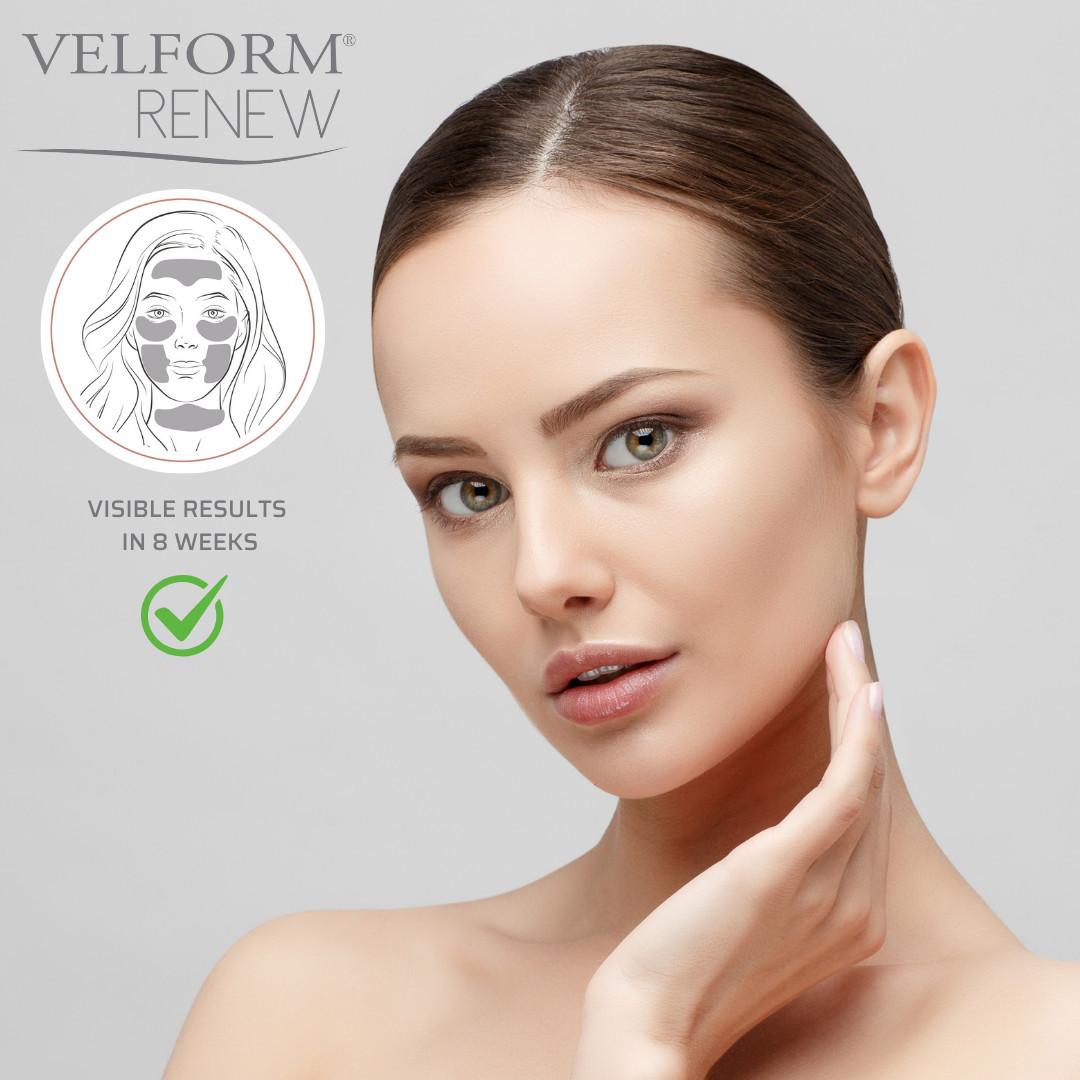 VELFORM  Renew 