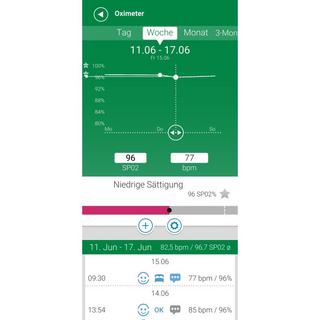 E+P Elektrik  pulsossimetro Plastica 