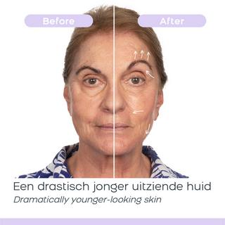 Derma Wand DermaWand PRO – Hautpflege  