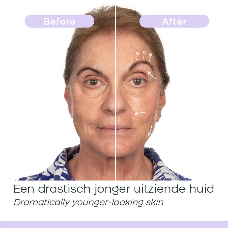 Derma Wand Derma Wand PRO Skin Care system  