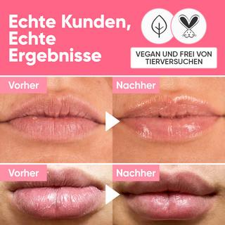 âme pure  BERRY SMOOTH Lippenbalsam - Feuchtigkeits Lippenbalsam für trockene Lippen mit süßen Beerengeschmack 