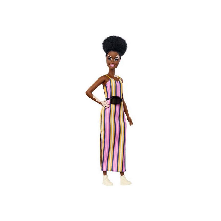 Barbie  Fashionistas Puppe Vitiligo mit Streifenkleid (Nr.135) 