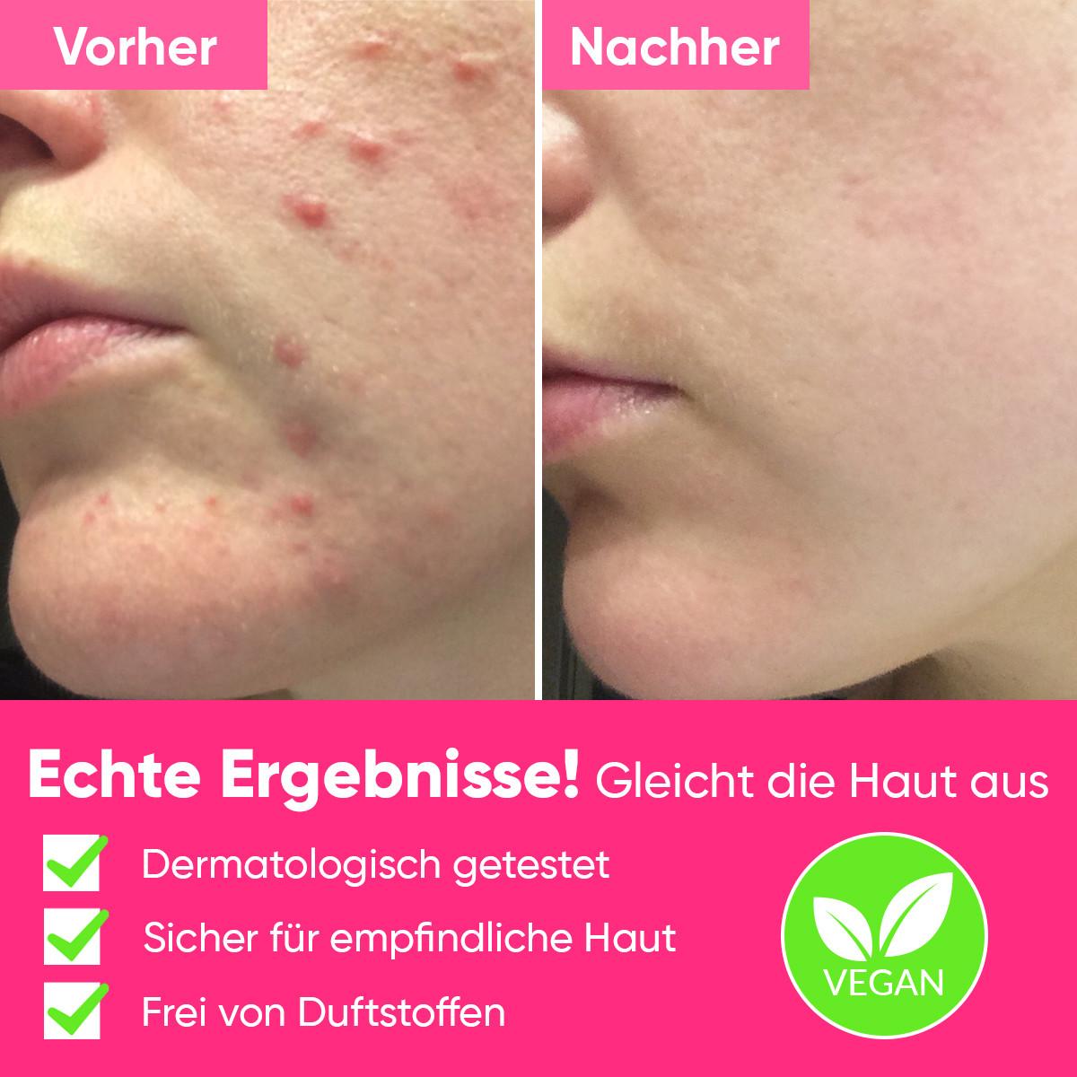 âme pure  Peels So Good - AHA / BHA-Gesichts Peeling-Gel mit Fruchtsäuren 