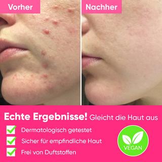 âme pure  Peels So Good - AHA / BHA-Gesichts Peeling-Gel mit Fruchtsäuren 